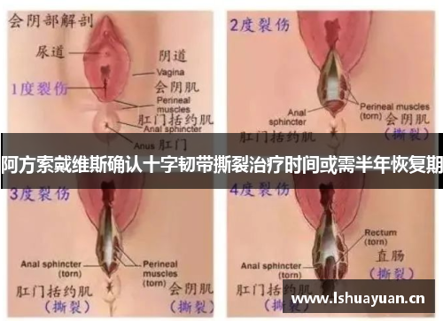 阿方索戴维斯确认十字韧带撕裂治疗时间或需半年恢复期 阿方索戴维斯确认十字韧带撕裂治疗时间或需半年恢复期